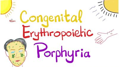 先天性红血球紫质缺乏症