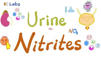 诊断尿路感染 - UTI（尿路感染） - 尿道亚硝酸盐（尿液分析）