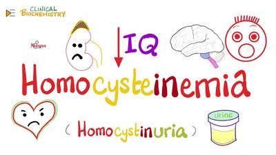 同型半胱氨酸血症