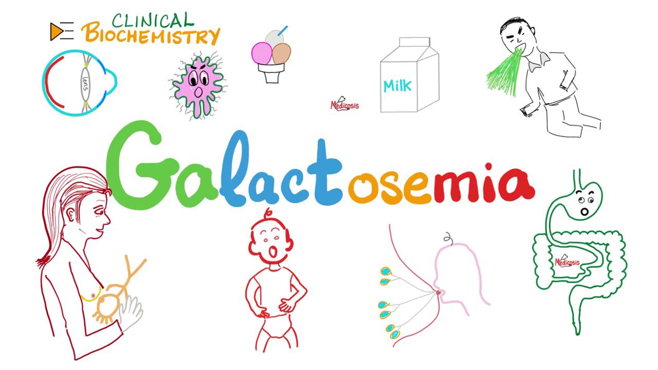 半乳糖血症